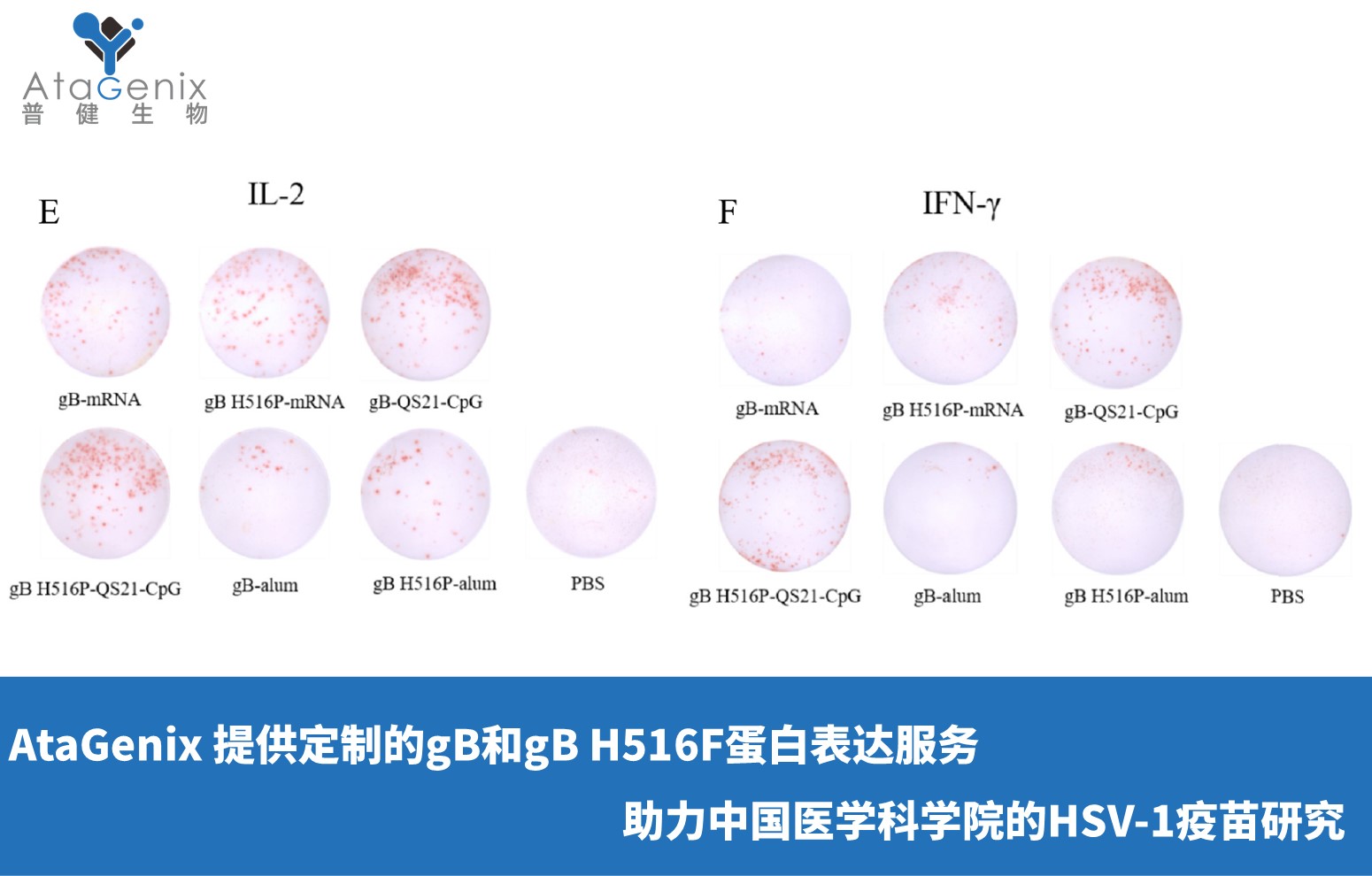AtaGenix 提供定制gB和gB H516F蛋白表达服务，助力中国医学科学院HSV-1疫苗研究